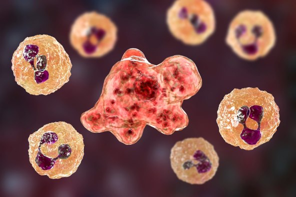 Djecak na plaži dobio infekciju amebe koja jede mozak