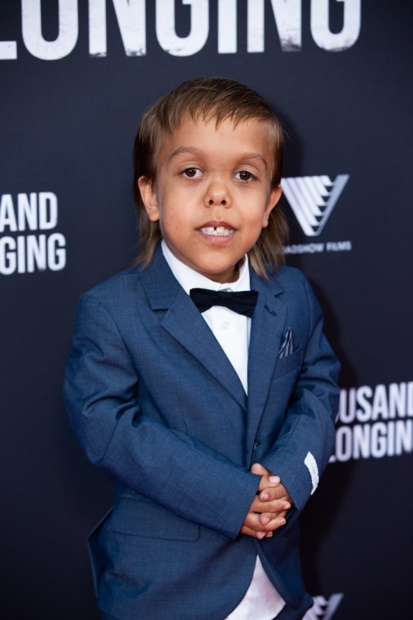 Zlostavljani djecak patuljastog rasta danas je filmska zvijezda