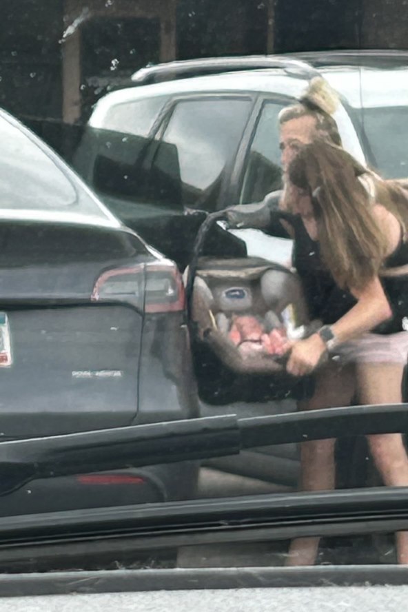 Sijamske blizanke koji dijele vaginu rodile dijete