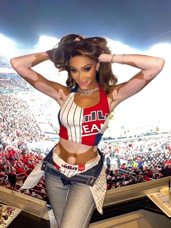 Modni trend otkopčanih hlača 