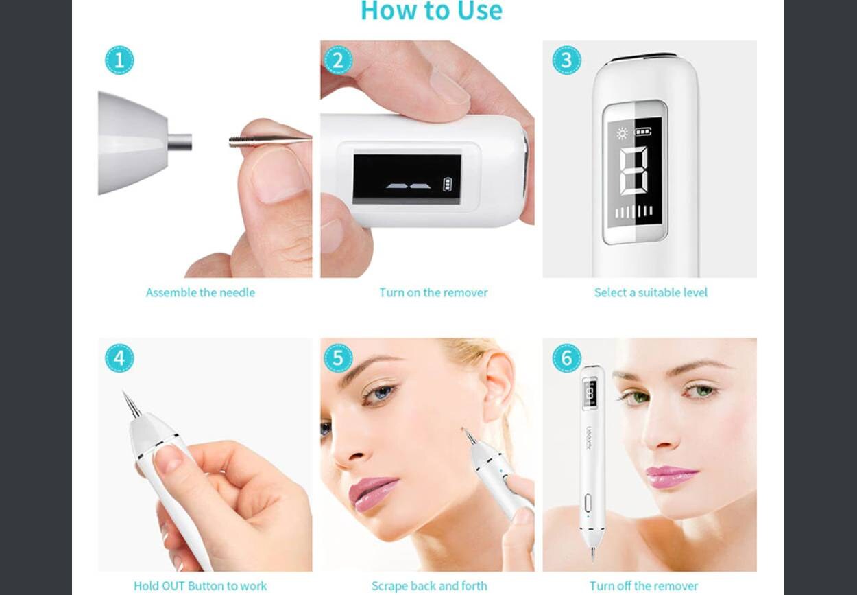 Laserska plazma olovka 4