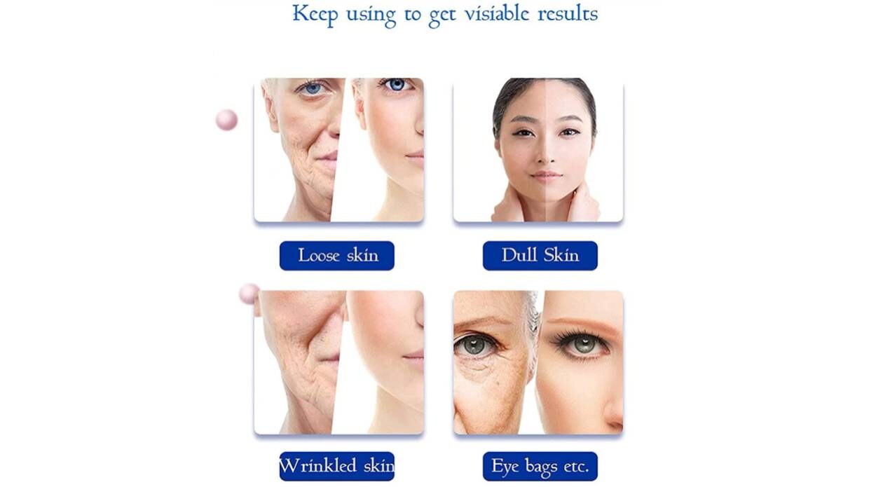 Uređaj za ljepotu lica 3.jpg