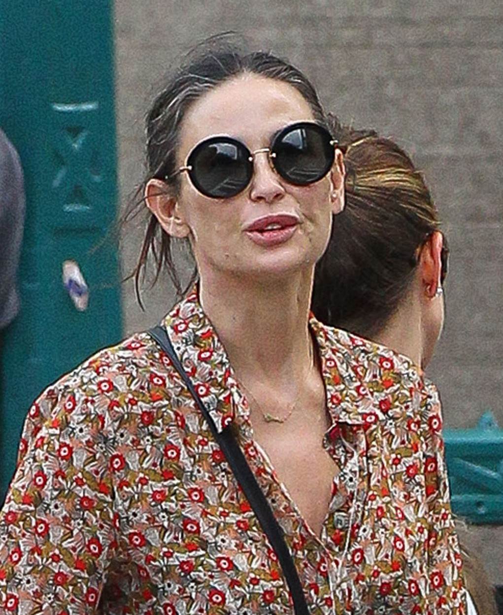 demi moore plastična operacija