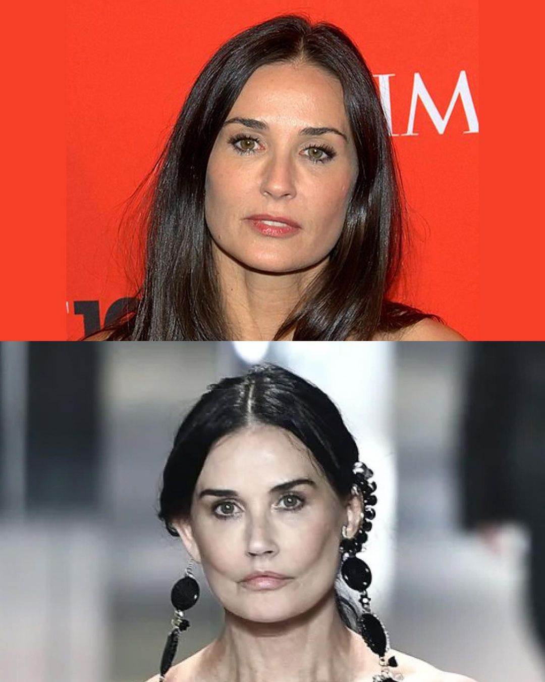 demi moore plastična operacija