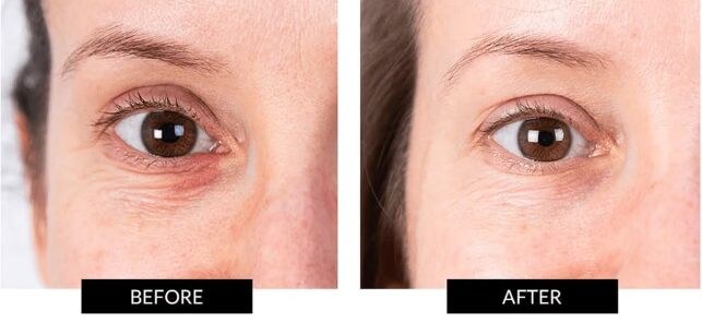 CurrentBody Skin LED Eye Perfector (5).jpg