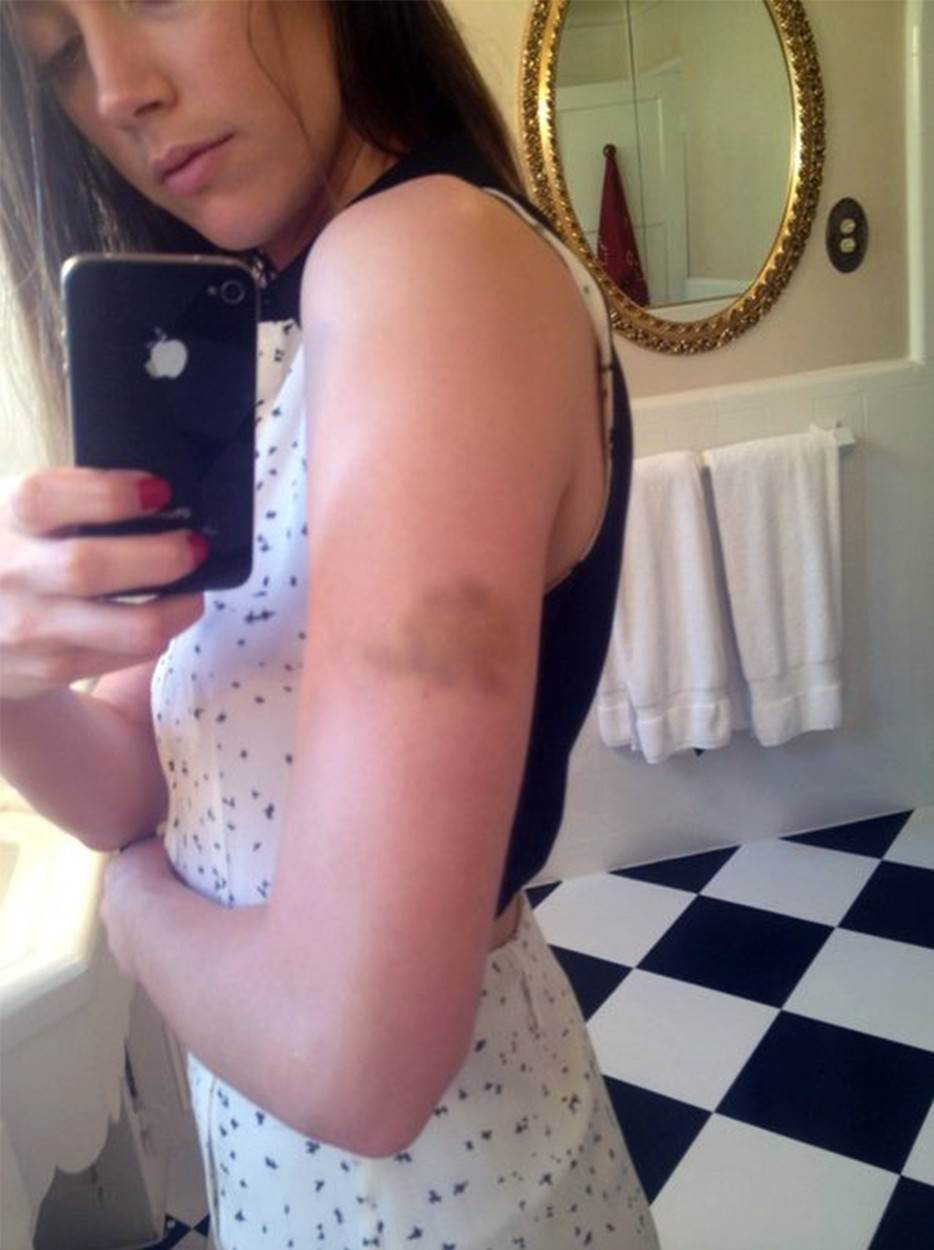 Amber Heard tvrdi da je Johnny Depp u braku bio nasilan