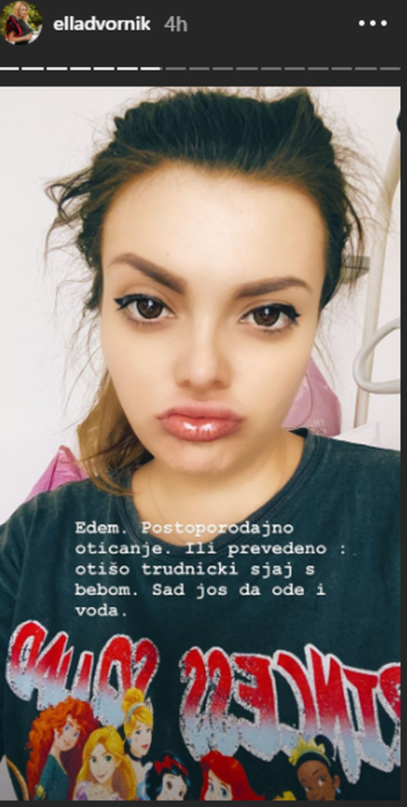 Ella Dvornik pokazala kako joj lice izgleda nakon porođaja
