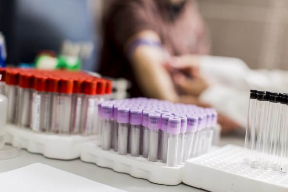 Što je ustvari kompletna krvna slika (KKS) u laboratorijskoj dijagnostici?