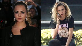Cara Delevingne treba stručnu pomoć
