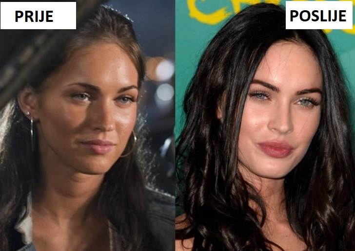 Megan Fox promijenila je izgled operacijama