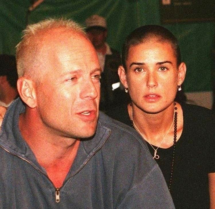 Izbotoksirano lice Demi Moore
