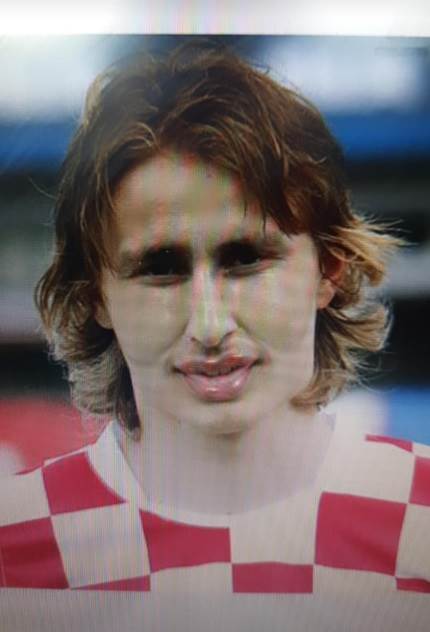kad bi slavni pretjerali s estetskim operacijama foto
