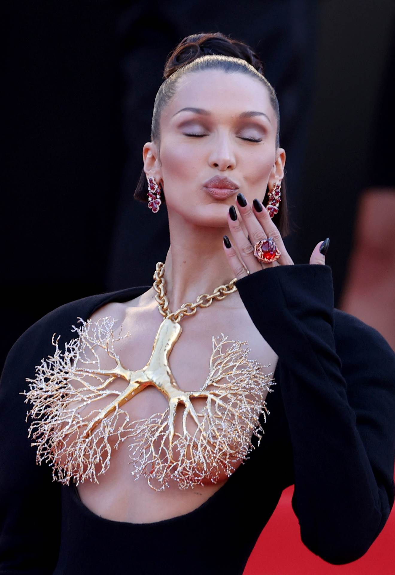 Koje estetske korekcije je radila Bella Hadid?
