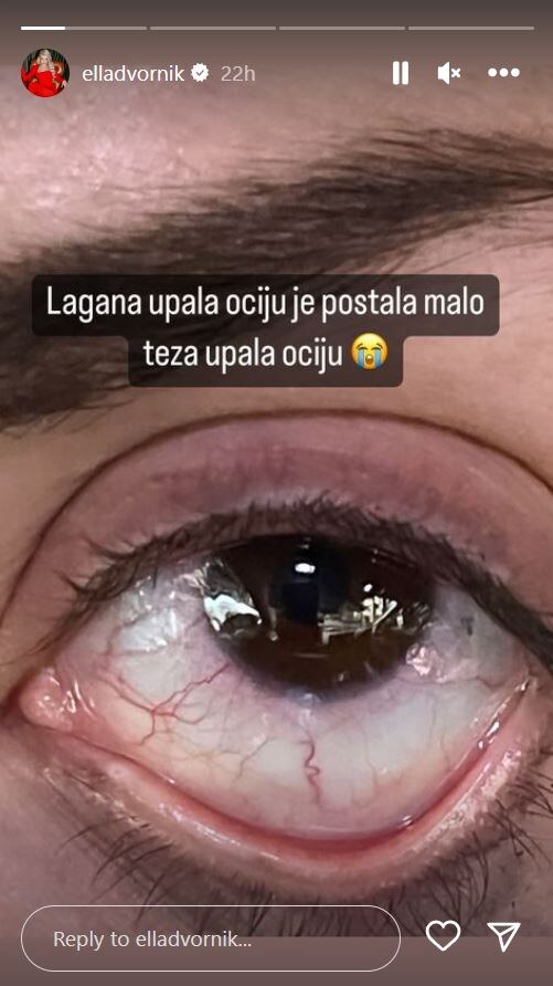 Ella Dvornik otkrila kako ima upalu očiju