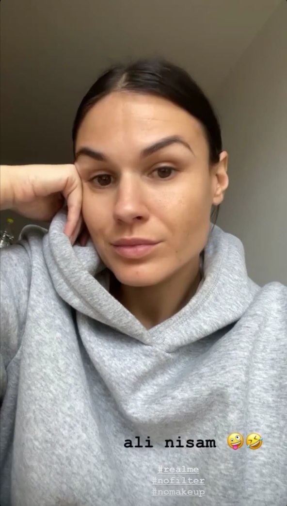 POKAZALA RAZLIKU Kako Matea Ibanez izgleda s filterima, a kako bez njih?
