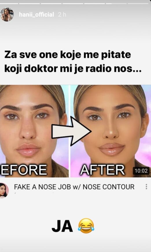 Hana Rodić progovorila o operaciji nosa