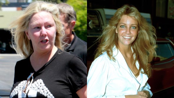 Heather Locklear upropastila je lice operacijama