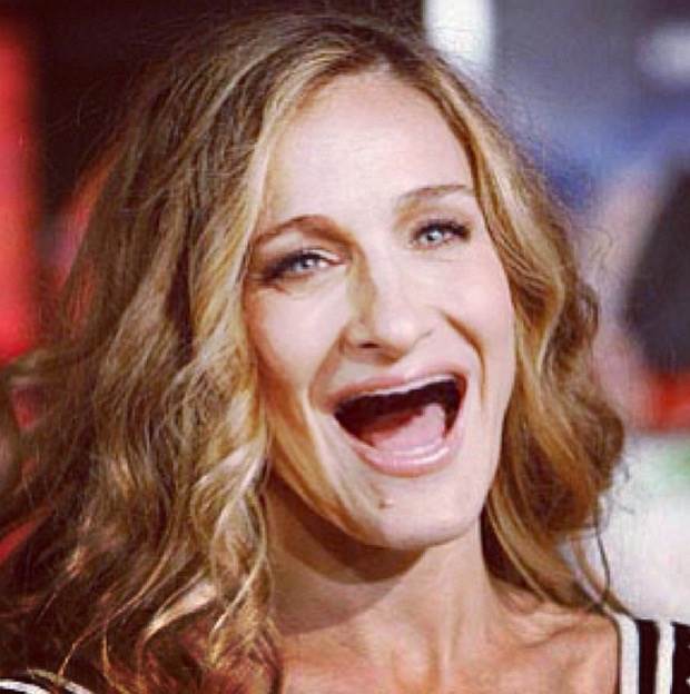 celebrities-without-teeth-4.jpg