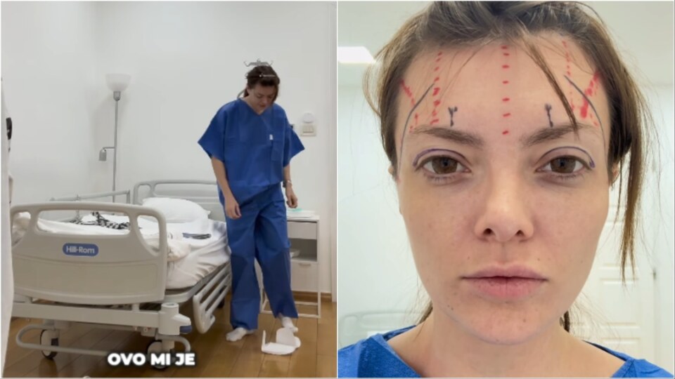 Ella Dvornik o estetskom zahvatu: 'Želim samo otvoreniji, odmorniji pogled' — image 2