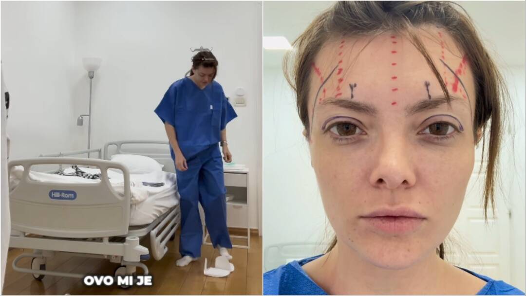 Ella Dvornik o estetskom zahvatu: 'Želim samo otvoreniji, odmorniji pogled'