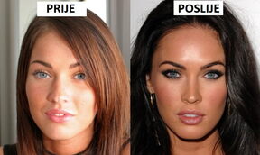 Megan Fox promijenila je izgled operacijama