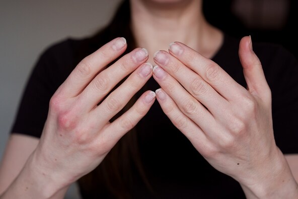 nokti, dermatolog