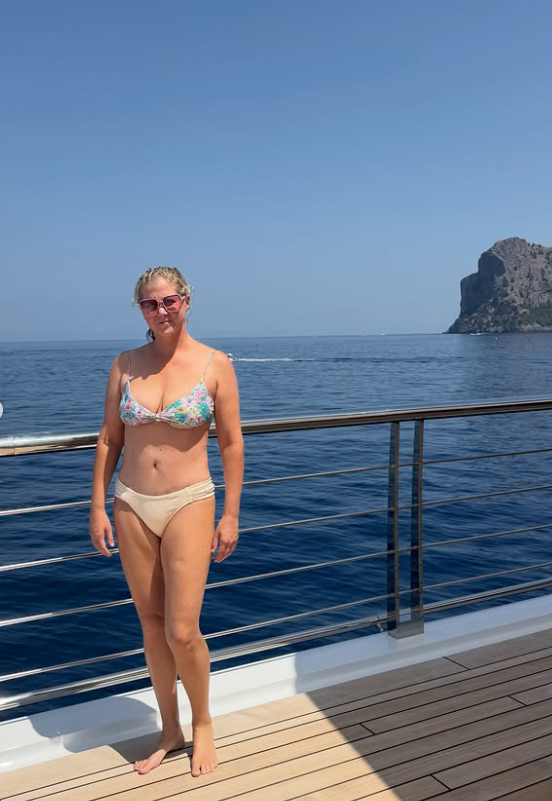 Amy Schumer