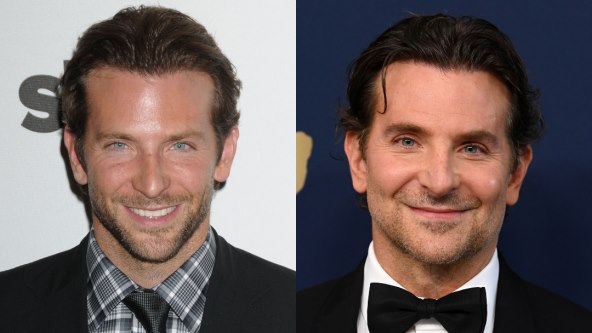 Bradley Cooper pretjerao s botoksom