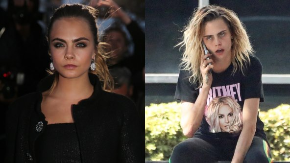Cara Delevingne treba stručnu pomoć