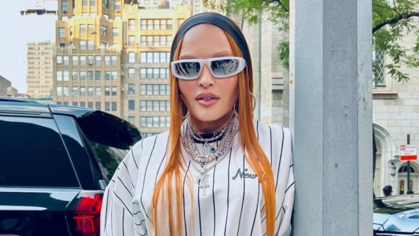 Madonna se uništila operacijama