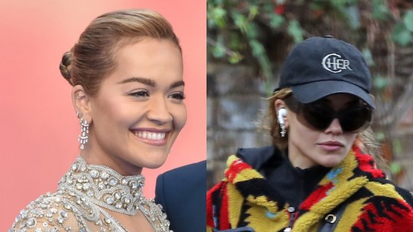 Rita Ora podvrgla se preoblikovanju čeljusti hijaluronskim filerima
