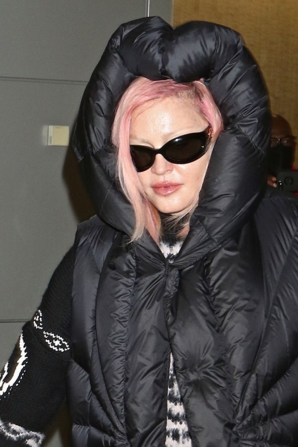 Madonna se unakazila filerima