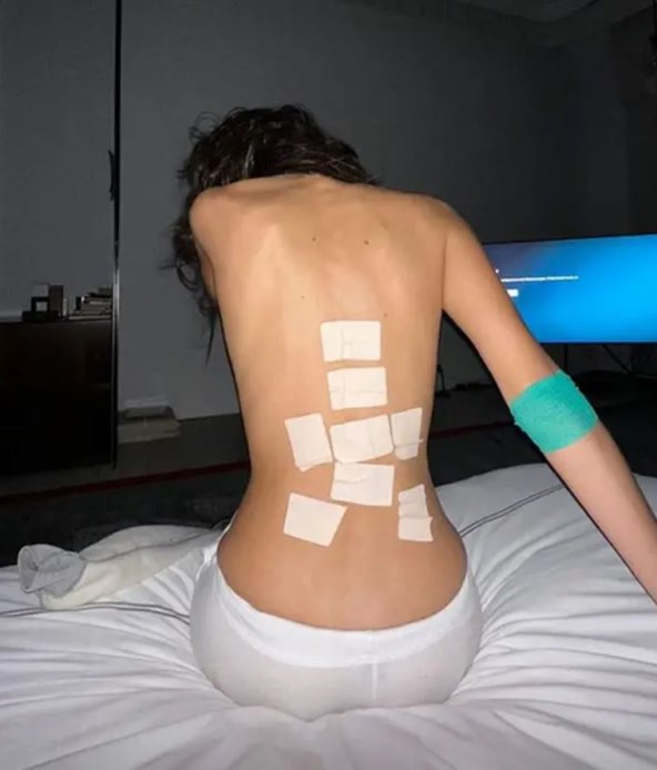 Bella Hadid zabrinula fotografijama modrica i zavoja