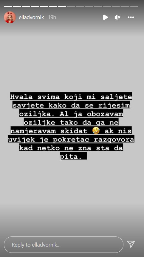 Ella Dvornik o ožilljku na nosu