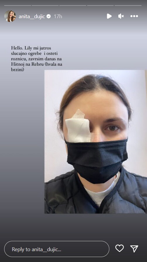 Anita Dujić završila na Hitnoj zbog ozljede oka