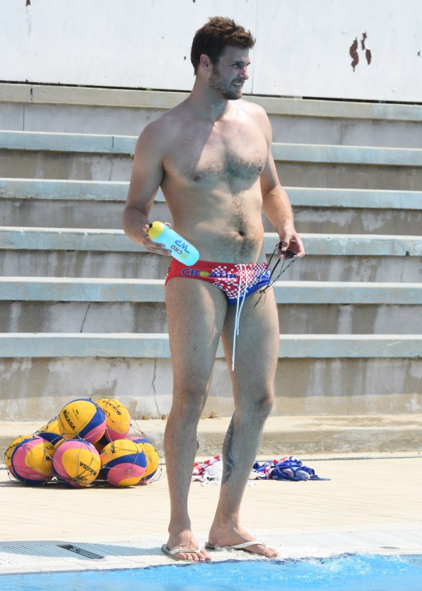 Ivan Buljubašić ima alopeciju.