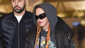 Madonna je lice unakazila plastičnim operacijama