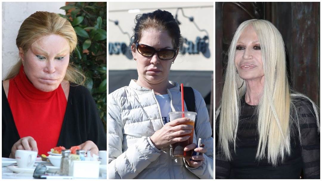 Jocelyn Wildenstein, Lara Flynn Boyle i Donatella Versace su lice uništile operacijama