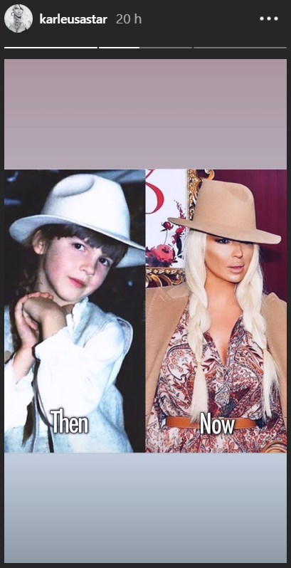 Karleuša novom fotografijom potvrdila estetske korekcije?