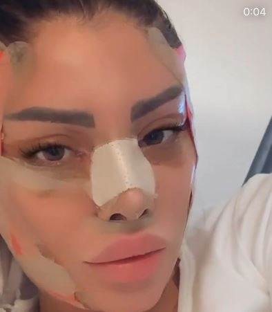 Annie Šukunda tetovirala lice supruga od kojeg se zamalo razvela