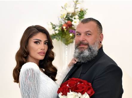 Annie Šukunda o estetskim zahvatima