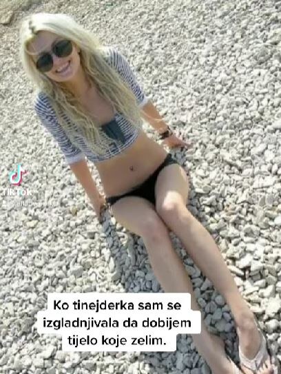 Ella Dvornik kad je imala samo 42 kilograma