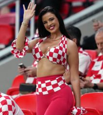 Kako je Ivana Knoll izgledala prije operacija?