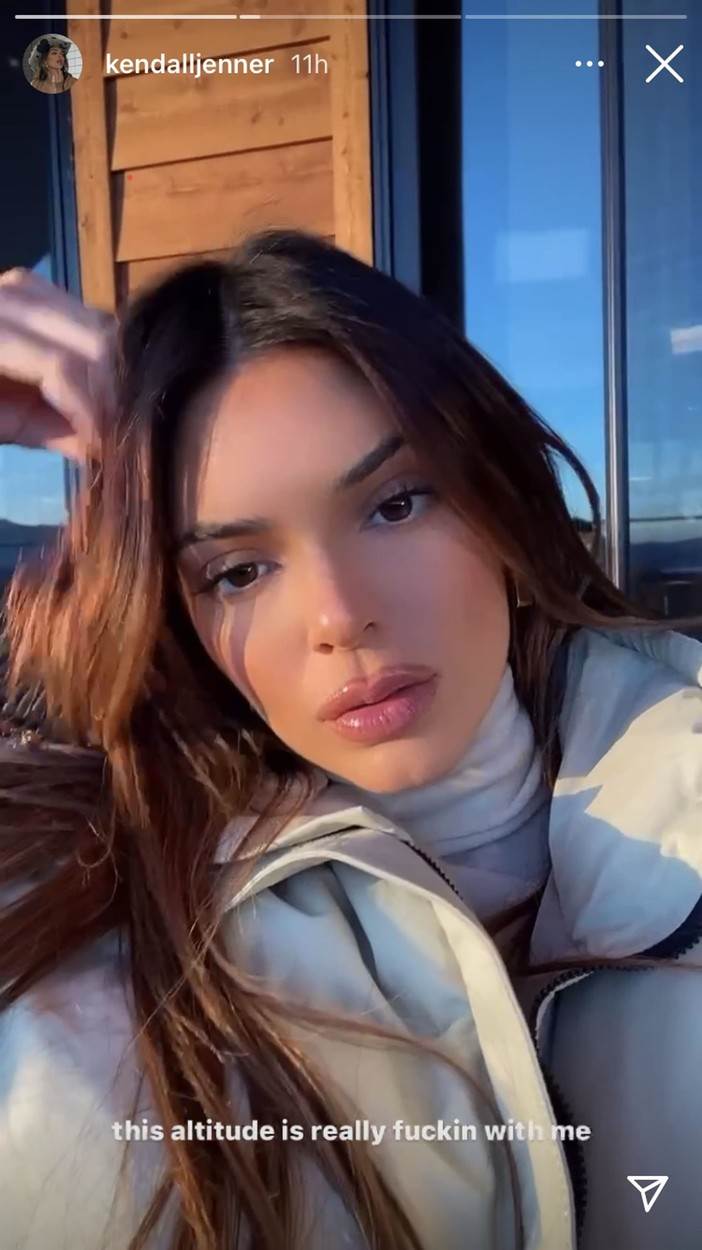 TRANSFORMACIJA KENDALL JENNER Koliko se 'popravila' tijekom godina