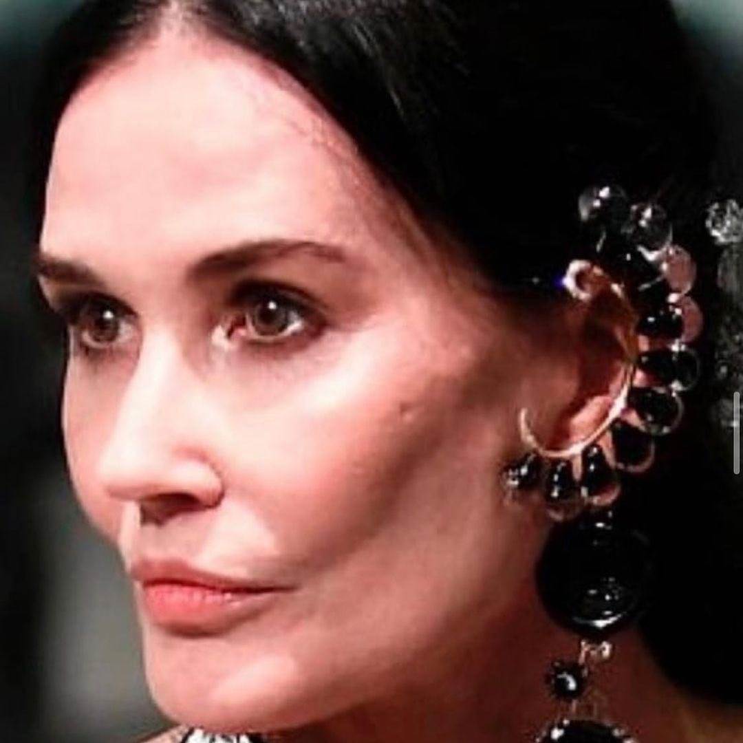 demi moore plastična operacija