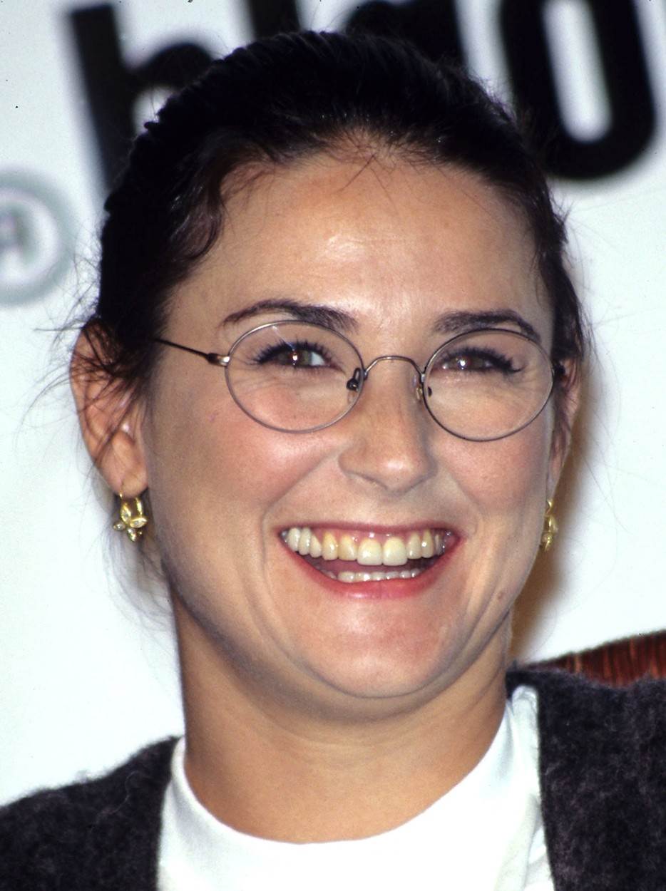 demi moore plastična operacija