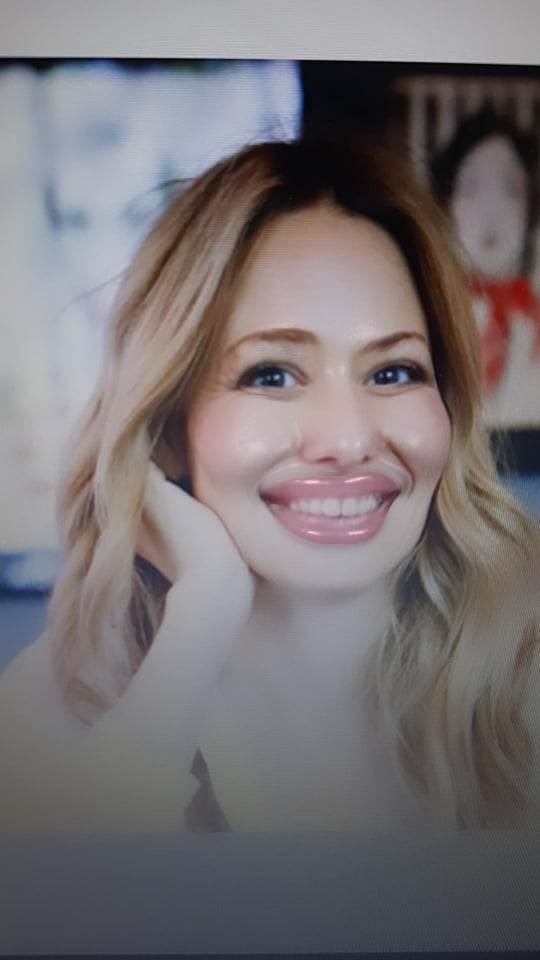 kad bi slavni pretjerali s estetskim operacijama foto