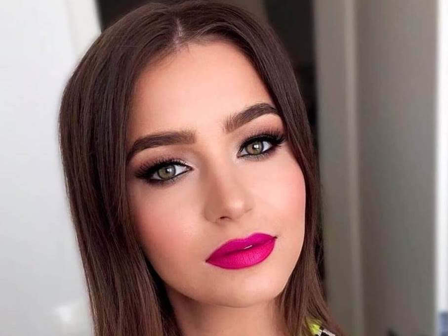 Kako danas izgleda Kim Verson?