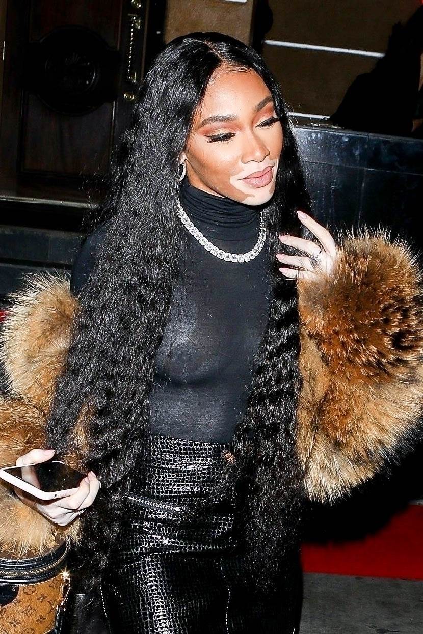 winnie harlow, dan bez grudnjaka