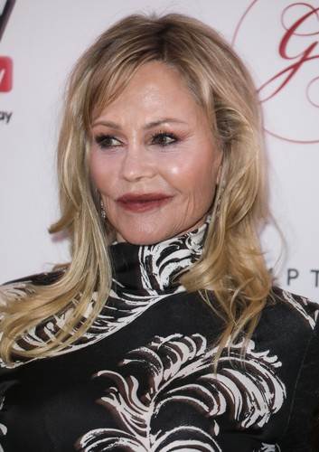 Melanie Griffith s ožiljkom na licu